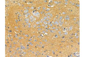 ABIN6259482 and ABIN6275755 at 1/100 staining Rat brain tissue by IHC-P.