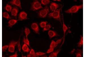 ABIN6273874 staining 293T by IF/ICC. (GPR4 抗体  (Internal Region))