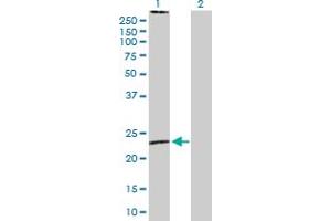 Western Blot analysis of MS4A2 expression in transfected 293T cell line by MS4A2 MaxPab polyclonal antibody.
