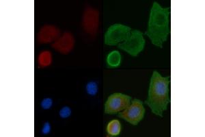 ABIN6258280 and ABIN6275235 staining Hela cells by IF/ICC. (MRPS25 抗体  (N-Term))