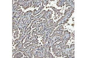 IHC analysis of RTCB using anti-RTCB antibody (ABIN7600722).