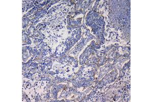 IHC analysis of Integrin alpha 5 using anti-Integrin alpha 5 antibody . (ITGA5 抗体  (AA 42-263))