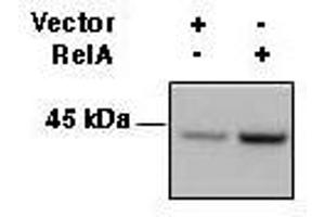 HLA-ABC 抗体