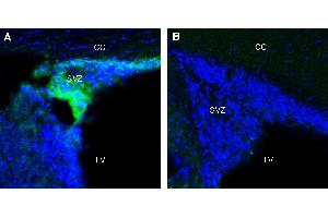 Expression of Adenosine A1 Receptor in rat subventricular zone (SVZ). (ADORA1 抗体  (Extracellular))