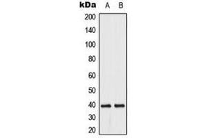 Western blot analysis of DUSP1/4 expression in HeLa (A), Jurkat (B) whole cell lysates. (MKP-1/2 抗体  (C-Term))