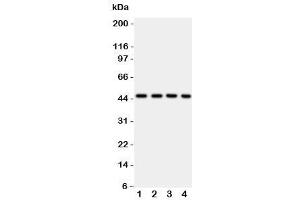 Western Blotting (WB) image for anti-Pyruvate Dehydrogenase Kinase, Isozyme 2 (PDK2) (C-Term) antibody (ABIN3032416)