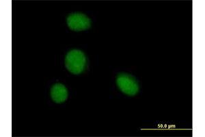 Immunofluorescence of purified MaxPab antibody to ZBTB6 on HeLa cell. (ZBTB6 抗体  (AA 1-424))