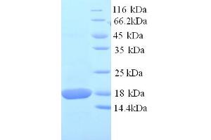 SDS-PAGE (SDS) image for Superoxide Dismutase 1, Soluble (SOD1) (AA 2-154) protein (His tag) (ABIN5713858)