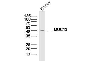 Lane 1: Mouse kidney lysates probed with Anti MUC13 Polyclonal Antibody, Unconjugated  at 1:300 overnight at 4˚C. (MUC13 抗体  (AA 175-270))