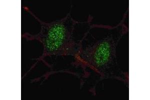 Fluorescent confocal image of SY5Y cells stained with SMAD2 antibody at 1:100. (SMAD2 抗体  (AA 97-125))
