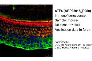 Image no. 1 for anti-Activating Transcription Factor 4 (Tax-Responsive Enhancer Element B67) (ATF4) antibody (ABIN2779919) (ATF4 抗体)