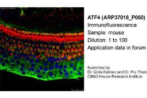Image no. 1 for anti-Activating Transcription Factor 4 (Tax-Responsive Enhancer Element B67) (ATF4) antibody (ABIN2779919) (ATF4 抗体)