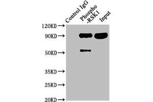 Immunoprecipitating Phospho-RPS6KA1 in Hela whole cell lysate Lane 1: Rabbit control IgG(1 μg)instead of ABIN7127743 in Hela whole cell lysate. (Recombinant RPS6KA1 抗体  (pSer380))