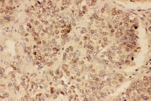 Immunohistochemistry (IHC) image for anti-SRY (Sex Determining Region Y)-Box 2 (SOX2) (AA 171-183), (Middle Region) antibody (ABIN3044477)