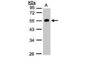 Western Blotting (WB) image for anti-Angiotensinogen (serpin Peptidase Inhibitor, Clade A, Member 8) (AGT) antibody (ABIN2133686)