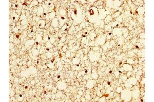 IHC image of ABIN7176635 diluted at 1:200 and staining in paraffin-embedded human brain tissue performed on a Leica BondTM system. (ZIC4 抗体  (AA 28-88))