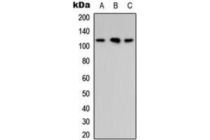 Western blot analysis of ARHGAP30 expression in MCF7 (A), Raw264. (ARHGAP30 抗体  (Center))