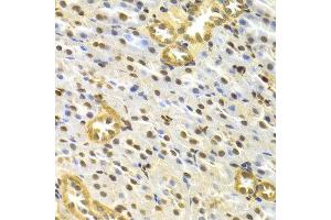 Immunohistochemistry of paraffin-embedded rat kidney using TP63 antibody at dilution of 1:100 (x400 lens). (p63 抗体)