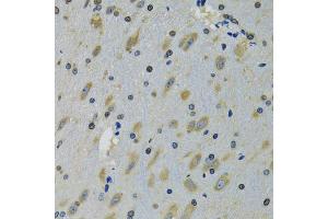 Immunohistochemistry of paraffin-embedded mouse brain using RPS12 antibody (ABIN5973491) at dilution of 1/100 (40x lens). (RPS12 抗体)