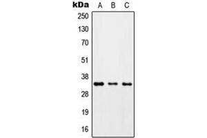 Western blot analysis of ZC3H8 expression in HepG2 (A), Raw264. (ZC3H8 抗体  (Center))