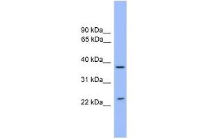 WB Suggested Anti-STX4 Antibody Titration: 0. (Syntaxin 4 抗体  (Middle Region))