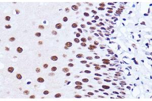 Immunohistochemistry of paraffin-embedded Human esophageal using MATR3 Polyclonal Antibody at dilution of 1:100 (40x lens). (MATR3 抗体)