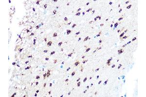 Immunohistochemistry of paraffin-embedded mouse brain using TPPP/p25 Rabbit mAb (ABIN7271031) at dilution of 1:100 (40x lens). (Tppp 抗体)