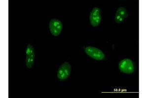 Immunofluorescence of monoclonal antibody to EXOSC5 on HeLa cell. (EXOSC5 抗体  (AA 1-235))