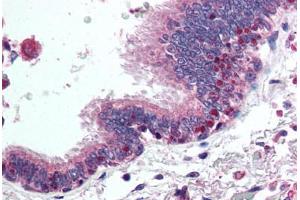 Human Lung, Respiratory Epithelium (formalin-fixed, paraffin-embedded) stained with HDAC4 antibody ABIN294416 at 5 ug/ml followed by biotinylated goat anti-rabbit IgG secondary antibody ABIN481713, alkaline phosphatase-streptavidin and chromogen. (HDAC4 抗体  (AA 194-209))