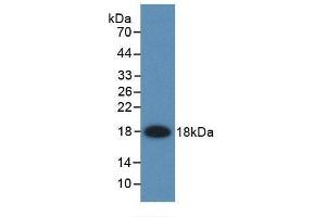 Detection of Recombinant FABP2, Rat using Monoclonal Antibody to Fatty Acid Binding Protein 2, Intestinal (FABP2) (FABP2 抗体  (AA 2-132))