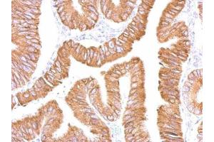IHC-P Image CES2 antibody detects CES2 protein at cytosol on human colon by immunohistochemical analysis. (CES2 抗体)