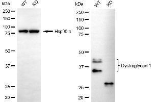 Western blotting analysis using dystroglycan 1 antibody (ABIN7798412). (Recombinant Dystroglycan 抗体)
