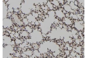 ABIN6267181 at 1/100 staining Mouse lung tissue by IHC-P. (SKP2 抗体  (pSer64))
