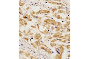 Antibody staining EGF in Human heart tissue sections by Immunohistochemistry (IHC-P - paraformaldehyde-fixed, paraffin-embedded sections). (EGF 抗体  (AA 690-720))