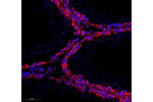 Immunofluorescence (Paraffin-embedded Sections) (IF (p)) image for anti-Major Intrinsic Protein of Lens Fiber (MIP) antibody (ABIN7074547)