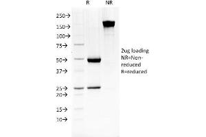 SDS-PAGE (SDS) image for anti-Heat Shock 27kDa Protein 1 (HSPB1) antibody (ABIN6939661)