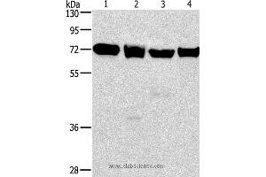 Western blot analysis of 231, 293T, Raji and hela cell, using IL2RB Polyclonal Antibody at dilution of 1:325 (IL2 Receptor beta 抗体)