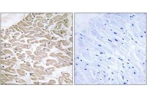 Immunohistochemistry (IHC) image for anti-Ras-Related Associated with Diabetes (RRAD) (AA 41-90) antibody (ABIN2890366) (RRAD 抗体  (AA 41-90))