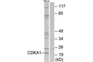 Western blot analysis of extracts from HeLa cells, using CDKPA1 Antibody. (CDK2AP1 抗体  (AA 51-100))