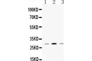Western blot analysis of HLA-DPB1 expression in rat spleen extract ( Lane 1), mouse spleen extract ( Lane 2) and JURKAT whole cell lysates ( Lane 3). (HLA-DPB1 抗体  (AA 30-258))