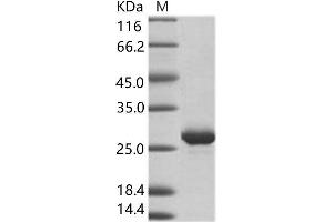 Western Blotting (WB) image for Zaire Ebolavirus Membrane-associated protein VP24 (ZEBOV VP24) protein (His tag) (ABIN7198933)