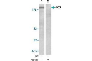 Western blot analysis of extracts from A-431 cells, untreated or EGF-treated (200 ng/ml, 30 min), using BCR polyclonal antibody  . (BCR 抗体)