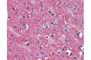 Immunohistochemistry (IHC) image for anti-Solute Carrier Family 1 (Glial High Affinity Glutamate Transporter), Member 2 (SLC1A2) (AA 467-516) antibody (ABIN6746998)