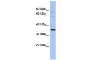 Image no. 1 for anti-NRBP2 (NRBP2) (AA 422-471) antibody (ABIN6744325) (NRBP2 抗体  (AA 422-471))