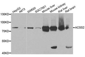 Western blot analysis of extracts of various cell lines, using ACSS2 antibody. (ACSS2 抗体)