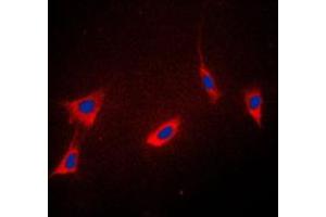 Immunofluorescent analysis of Cyclophilin F staining in K562 cells. (PPIF 抗体  (Center))