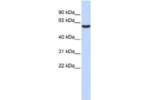 Western Blotting (WB) image for anti-gamma-aminobutyric Acid (GABA) A Receptor, beta 3 (GABRB3) (Middle Region) antibody (ABIN2776245)