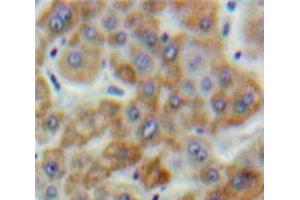 Used in DAB staining on fromalin fixed paraffin-embedded Liver tissue (SSFA2 抗体  (AA 276-510))