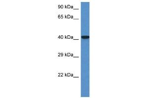 WB Suggested Anti-Zfp759 Antibody   Titration: 1. (Zfp759 抗体  (N-Term))