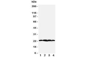 Western blot testing of BAG2 antibody;  Lane 1: rat testis;  2: HeLa;  3: A549;  4: A431 cell lysate. (BAG2 抗体  (N-Term))
